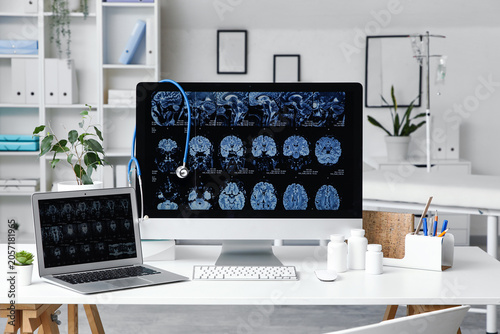 Medical brain scan imaging ...