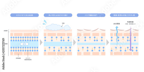 セラミド減少によるバリア機能低下と乾燥肌のメカニズムを解説するイラスト
