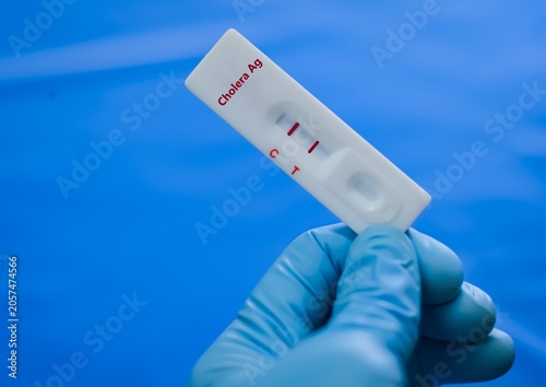 Fotografie The sample of patient positive result for cholera Ag.