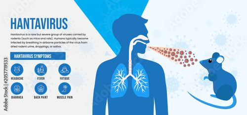 Fotografie Hantavirus Disease (Hantaviruses) – Rodent-Borne Viral Infection, Symptoms, Prev