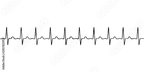 Foto Heartbeat ECG graph on white background showing medical cardiogram pulse wave il