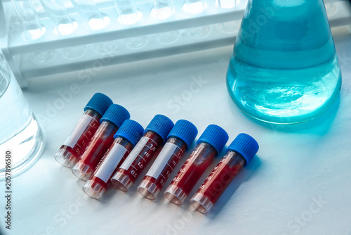 Blood samples in test tubes with blue caps on laboratory table, medical diagnostics and clinical analysis concept with healthcare research and testing environment