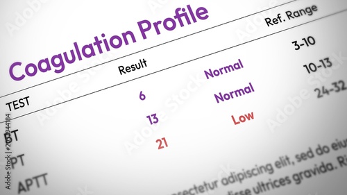 Foto Coagulation profile test results showing normal and low levels in blood analysis