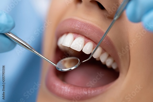 Close-up of a patient's open mouth during a dental examination with a mirror and probe.