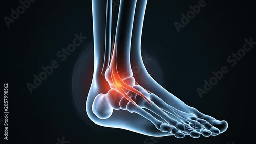 Transparent Ankle Illustration with Highlighted Lateral Ligaments for Ankle Sprain Concept in Medical and Educational Visuals