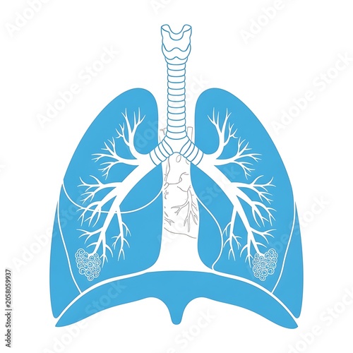 Blue lungs with white bronchial tree illustration against white background.