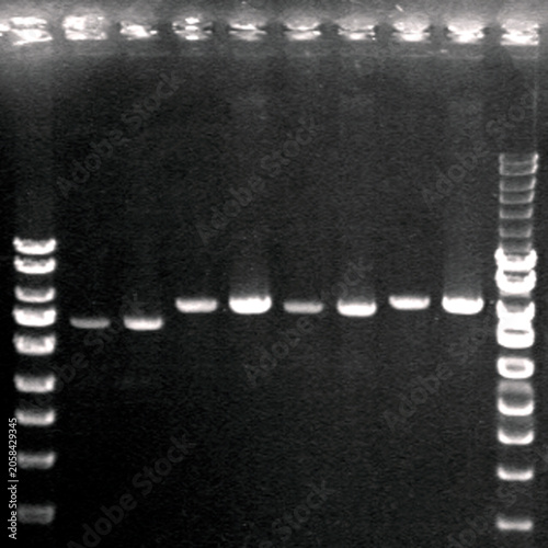DNA fragments separated on an agarose gel containing Ethidium Bromide and visualised under UV light