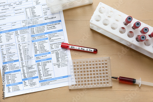 HIV blood test tubes and la...