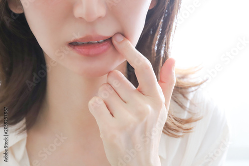 Bild auf Leinwand 口内炎を気にする女性のクローズアップ