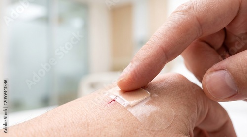 Close-up of a hand applying a clear adhesive bandage over a fresh cut on skin