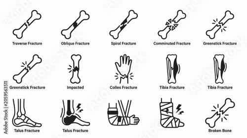 Foto Common bone fracture types and orthopedic injury line icon set