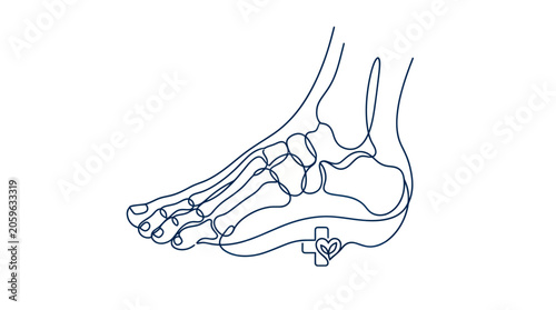Photos Ankle bone with metal surgical implant.