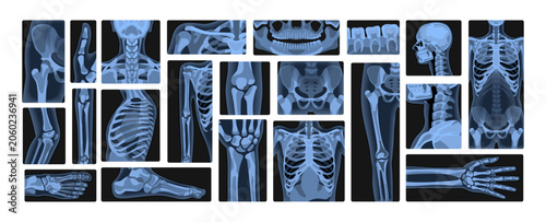 Slika na platnu Set of human body x rays