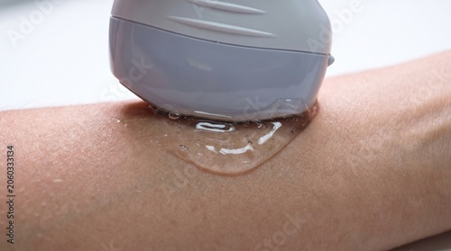 Macro shot of ultrasound probe on skin with medical gel