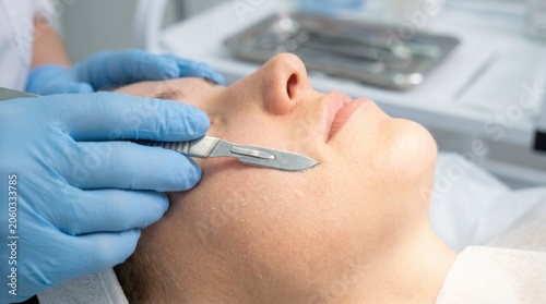 Professional dermaplaning facial treatment on woman's skin