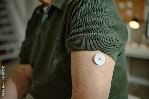 Close up of senior patient wearing glucose monitor during doctor visit in clinic, showing diabetes management and preventive care. Ideal for healthcare marketing and senior wellness campaigns