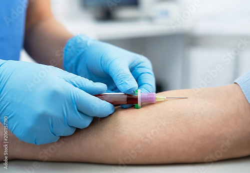 Bild auf Leinwand Blood sampling procedure in hospital close up.