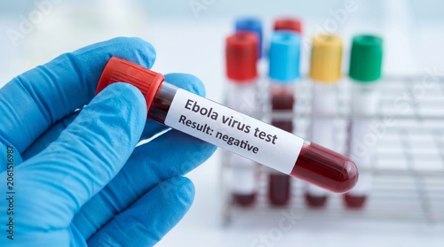 Hand holding a test tube with blood for Ebola virus test, result negative