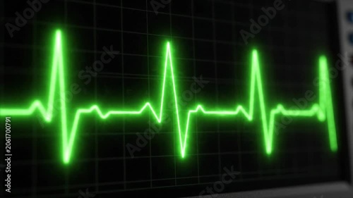 Glowing green heartbeat pulse line on grid background medical