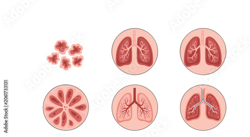 Set of six anatomical diagrams showing different cross sections and internal structures of the human lungs and airway system.