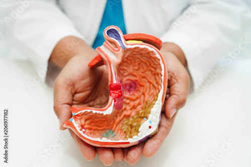 Cuadro en lienzo Stomach disease, doctor holding anatomy model for study diagnosis and treatment in hospital