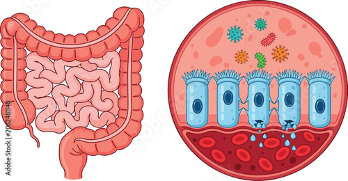 Obraz na płótnie Human Gut Anatomy and Leaky Gut Syndrome Diagram Featuring Intestinal System Flo