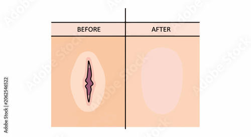 Split-screen comparison showing a wound healing from a jagged opening to smooth skin