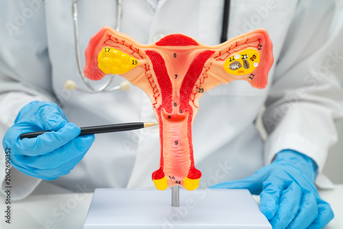 Uterus, doctor holding human anatomy model for study diagnosis and treatment in hospital.