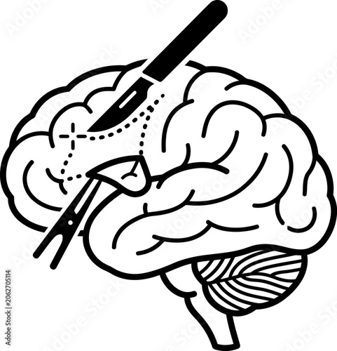 Human brain surgery outline icon, medical procedure