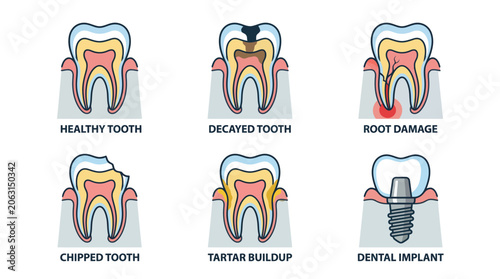 Six dental healthcare diagrams showcasing orthodontic treatment and root canal