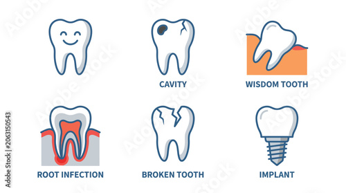 Comprehensive dental implant infographic showing bone structure and artificial tooth