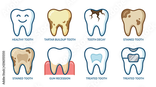 Set of six tooth restoration diagrams showcasing dental fill crown and implant
