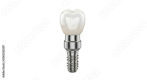 Dental implant with ceramic tooth crown isolated on white background