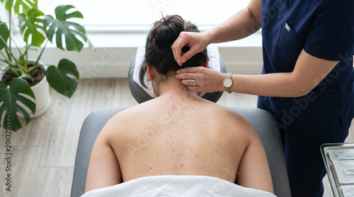 A young Caucasian woman receives acupuncture treatment on her neck. A practitioner, wearing a blue uniform, carefully places needles. Indoor setting with plants.