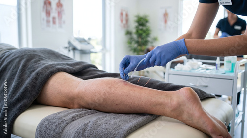 A close-up of a person's leg receiving acupuncture treatment. A gloved hand inserts a needle into the skin. The setting is a clean, modern clinic with anatomical charts in the background.