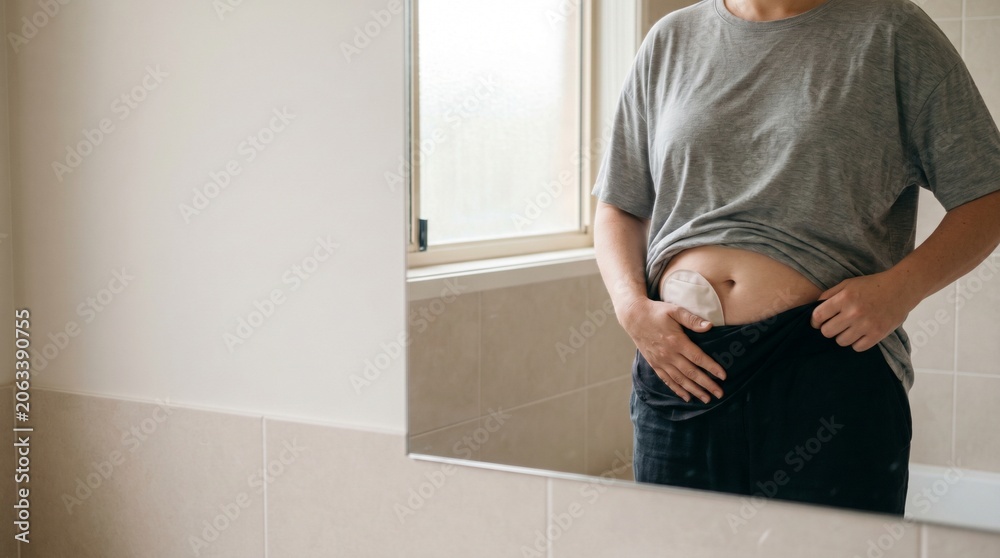 Fototapeta premium Adult person checking an ostomy pouch on the abdomen in a bathroom mirror, concept of stoma care, body confidence and life after bowel surgery.