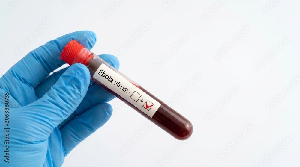 Obraz premium Distressed woman holding positive ebola virus blood test in laboratory setting