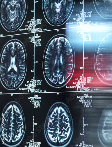 MRI brain scans displayed in a series, showcasing detailed neural imaging patterns.