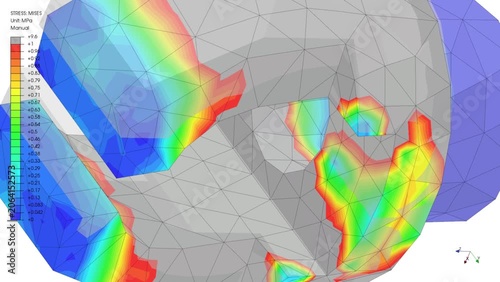 Mechanic simulation engineering - Stress and breakpoint analysis of Mechanical part under force and moment conditions