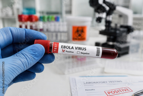 A healthcare worker is handling a test tube marked with Ebola virus positive in a laboratory. The worker is wearing gloves and surrounded by testing materials.