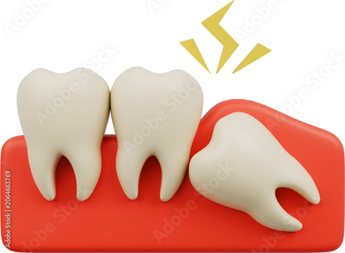 фотографія wisdom tooth
