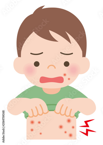 とびひができている男の子