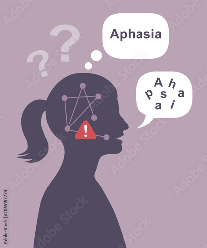 Aphasia Speech and Language Disorder – Neurological Communication Impairment Vector Illustration
