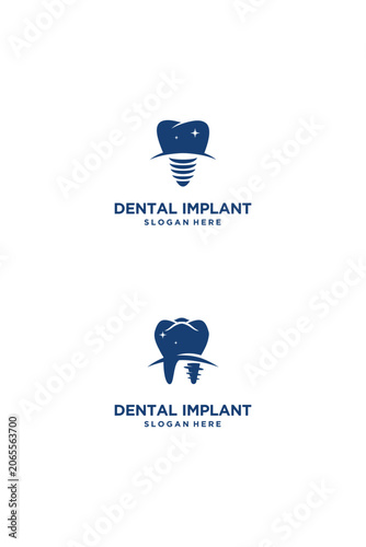 Dental Implant Logo Design for Professional Dental Clinic.