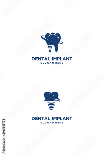 Dental Implant Logo Design Modern and Professional Concept.