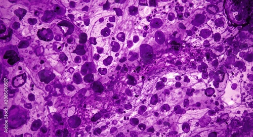 Microscopic view of hippoca...