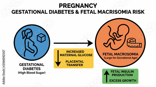 Obraz na płótnie Pregnancy Gestational Diabetes Fetal Macrosomia Risk Diagram