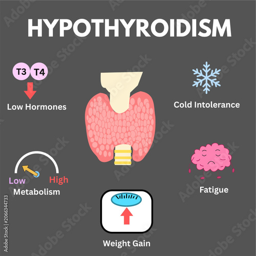 hypothyroidism symptoms medical illlustration.eps