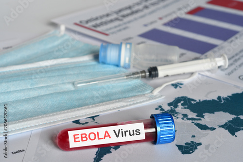 Foto Blood tube for test detection of virus Ebola on papers documents.