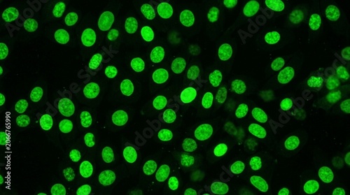 Antinuclear Antibody ANA Immunofluorescence Pattern for Lupus Diagnosis